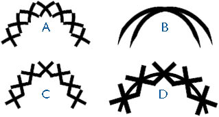 figure 23-18. the single, repeating element in each of these line patterns is an × shape. in pattern a the × is tiled and bent to follow the line. in pattern b the × is tiled but not bent. in pattern c the × is stretched along the line, and in pattern d the × is tiled at intervals like beads on a string.