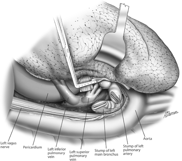 Fig. 